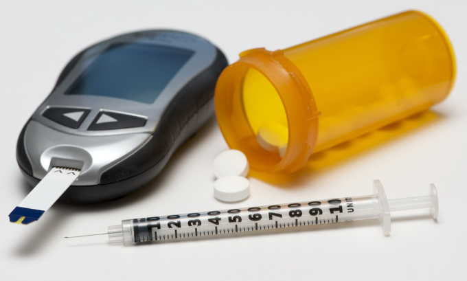 Панкреатит часто становится причиной развития сахарного диабета