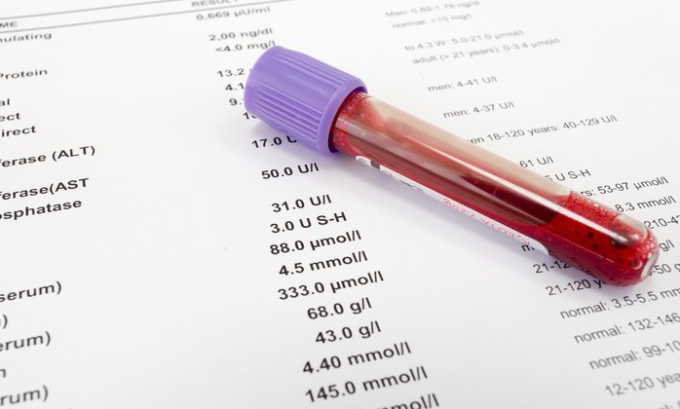 Высокий уровень амилазы в анализе крови свидетельствует о наличии воспаления