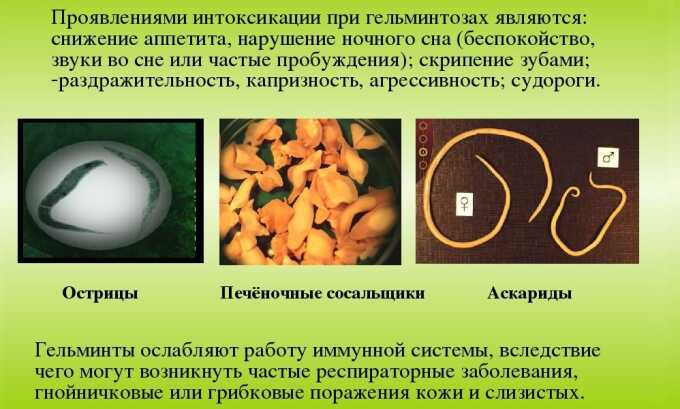 Глистные инвазии могут быть причиной заболевания