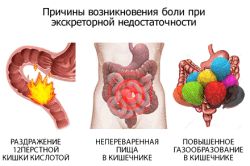 Причины возникновения боли при секреторной недостаточности поджелудочной железы