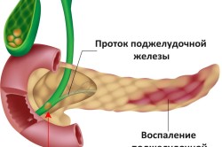 Как болит спина при заболевании поджелудочной железы thumbnail