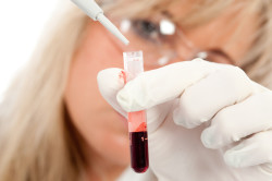 Анализ крови для выявления патологии