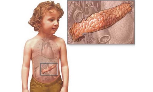 У детей 8 лет и старше патология была вызвана нерегулярностью питания, сухоедением. В группе детей 6-9 лет факторами, вызвавшими панкреатит
